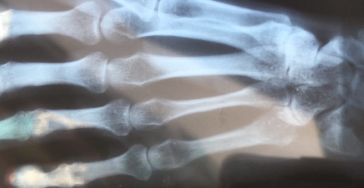 Let me give you a hand Let me give you a hand