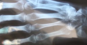 Let me give you a hand